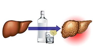 Az alkohol egészségre gyakorolt hatása a szívre)